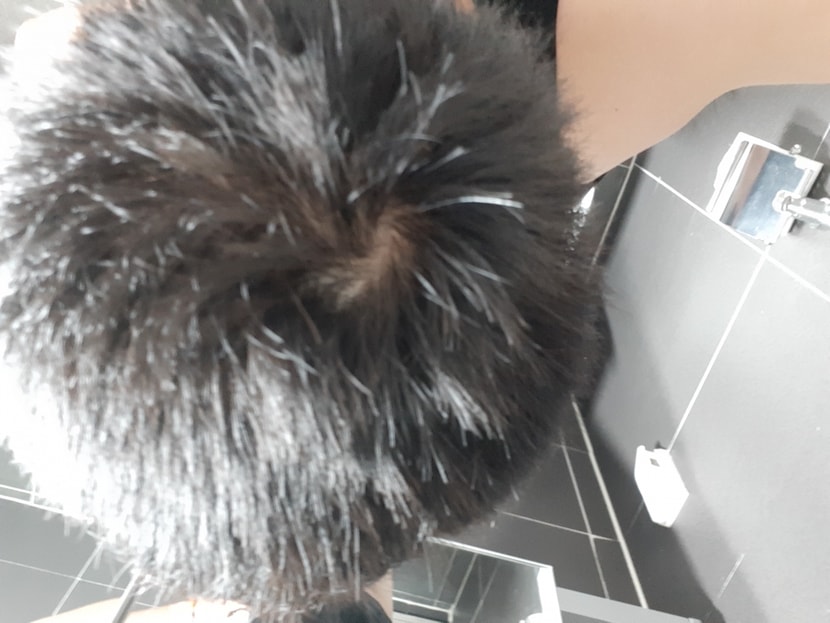 정수리