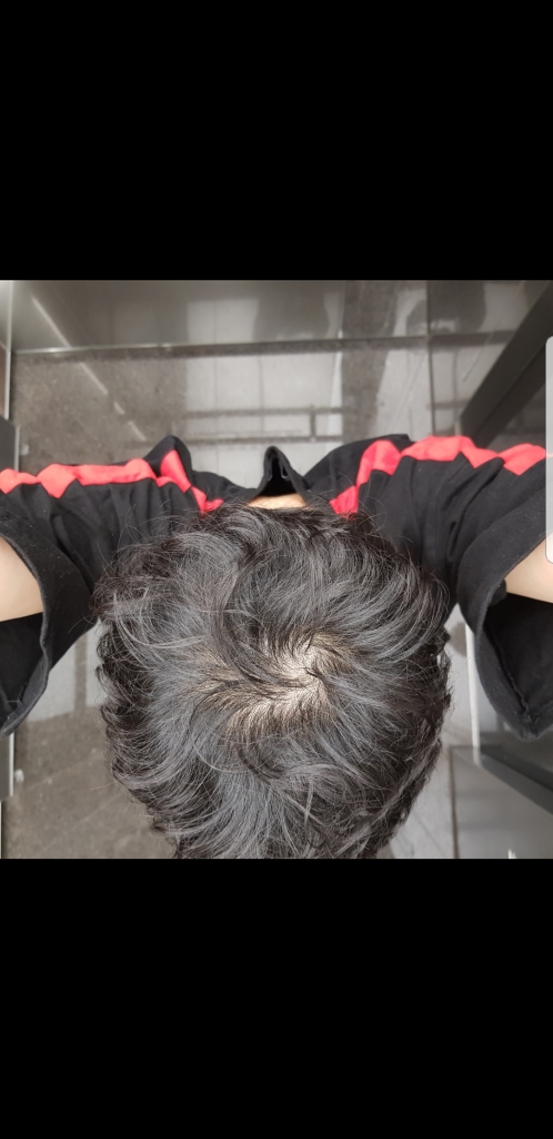 Screenshot_20180503-164136_Gallery.jpg
