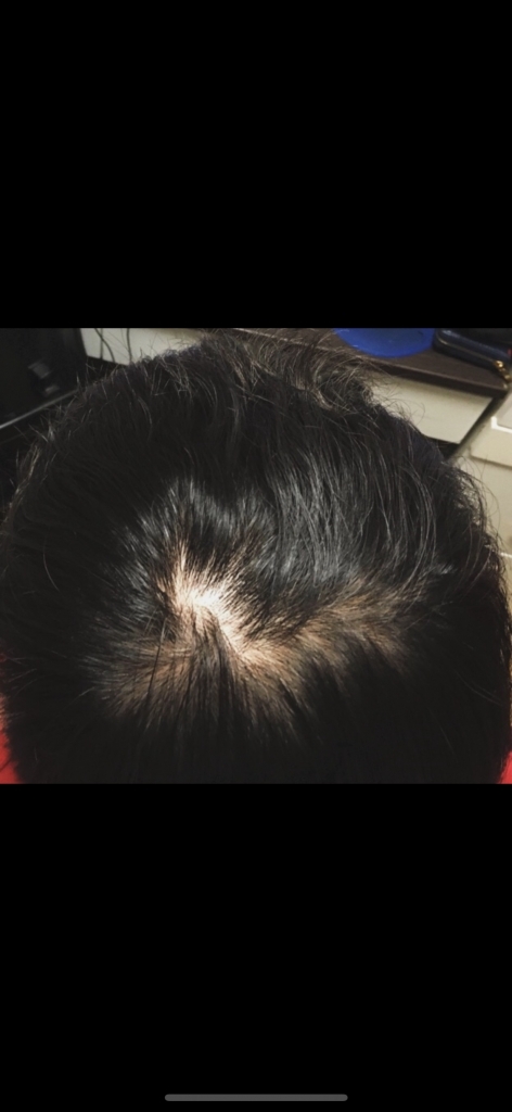921F8CE0-88C1-4F06-BE42-3956352164A2.png