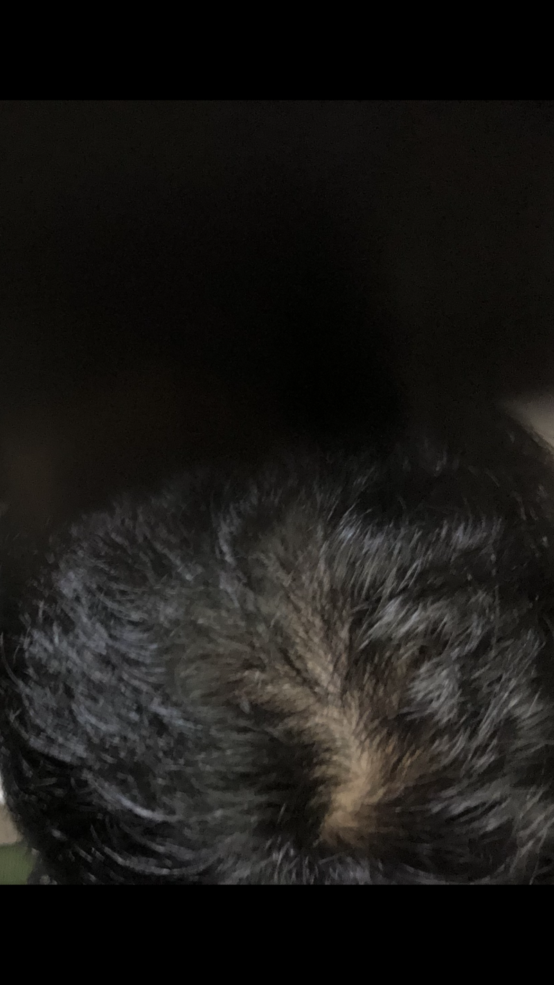 5516E05C-FD61-402D-B624-31D521BCFAF2.png