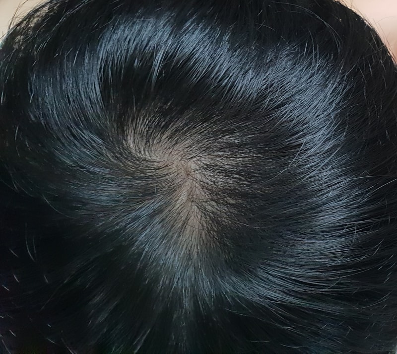20180820_090344.jpg