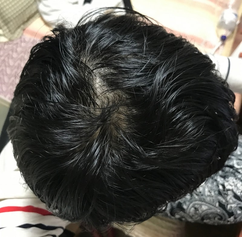 사본 -약 먹기 전 속알머리.jpg