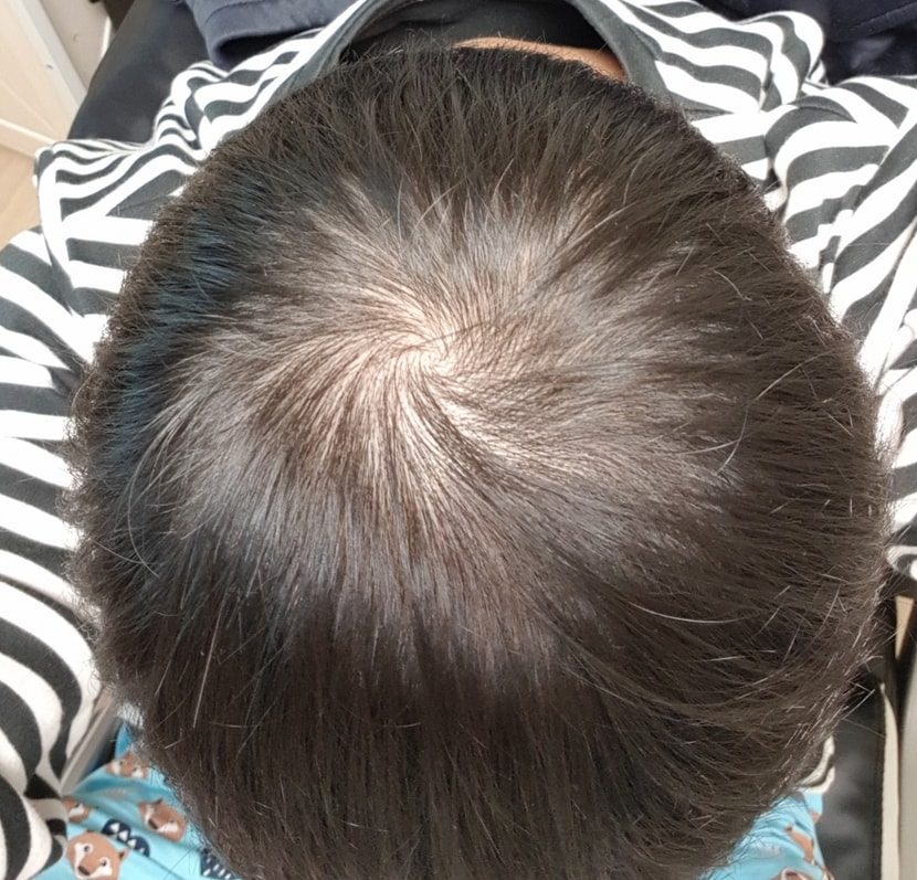 복용 1개월
