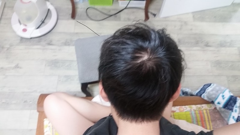 먹고 2달.jpg