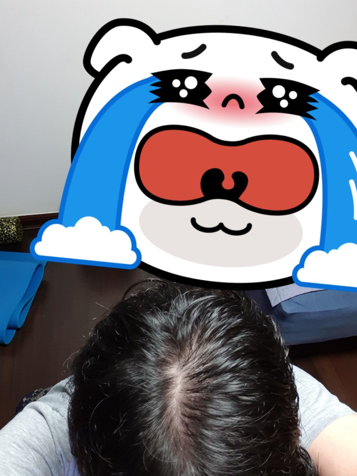 정수리1.jpg