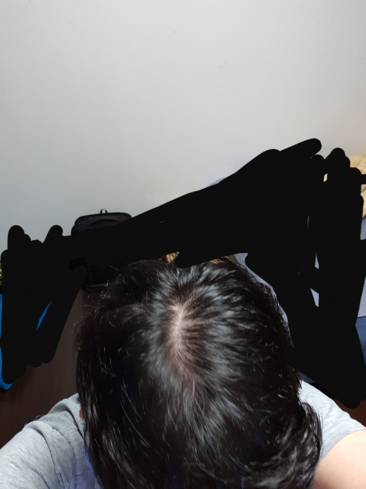 정수리2.jpg