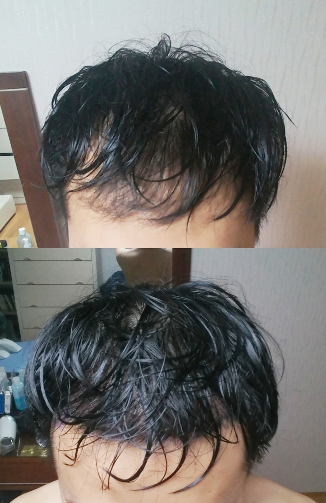 전후2.jpg
