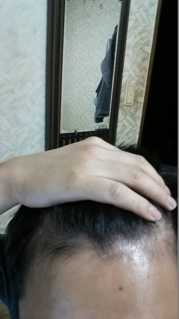 20140925_041316.jpg