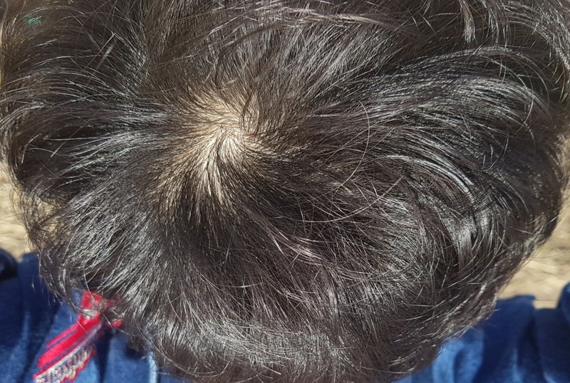 20180218_011004.jpg