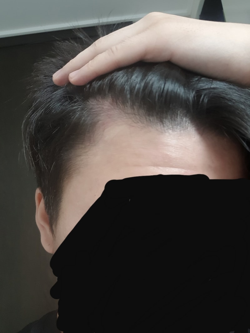 앞머리2.jpg