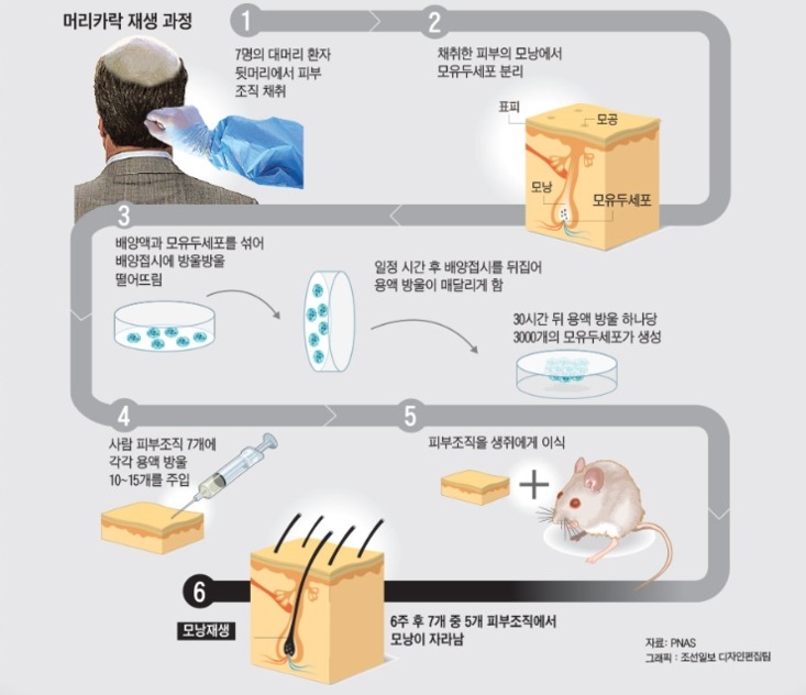탈모__~1.JPG