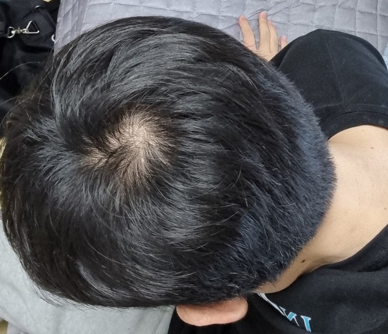 내머리3.jpg