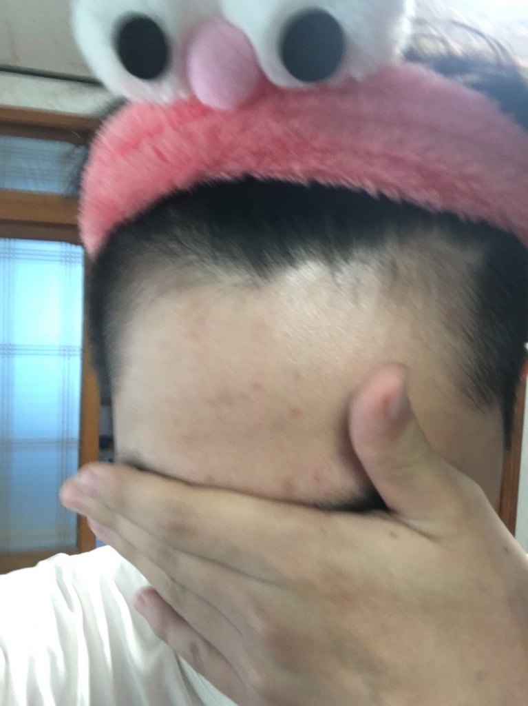 B052B9BB-CBBB-47E8-ACE0-57D6634EED3B.jpeg