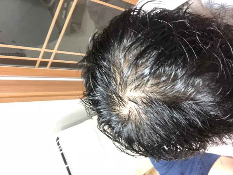 D4904146-A9BD-44AF-8E6F-DF571DB8478F.jpeg