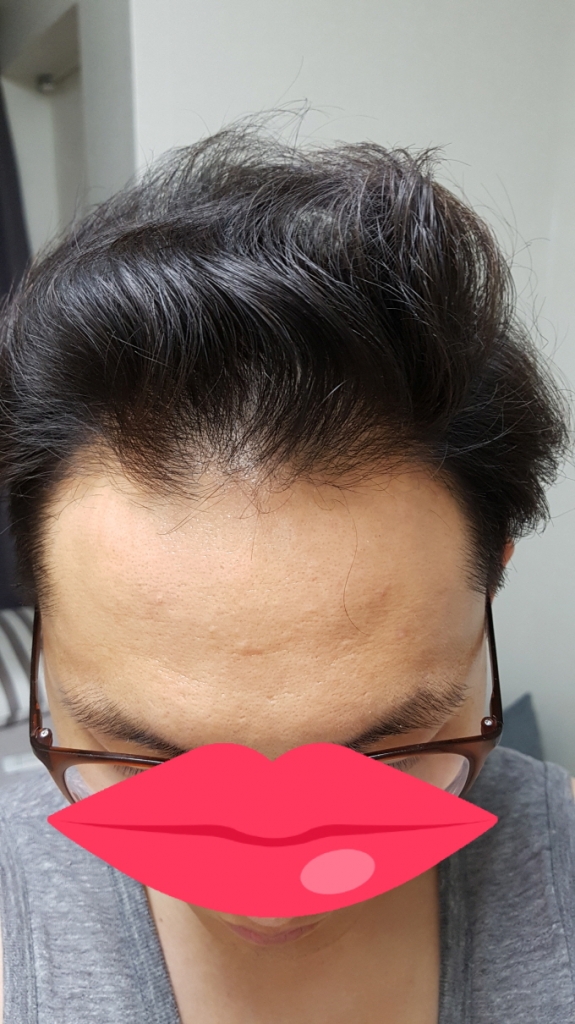 정면6.jpg