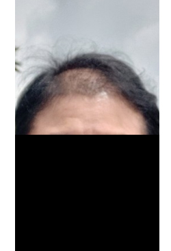 머리.JPG