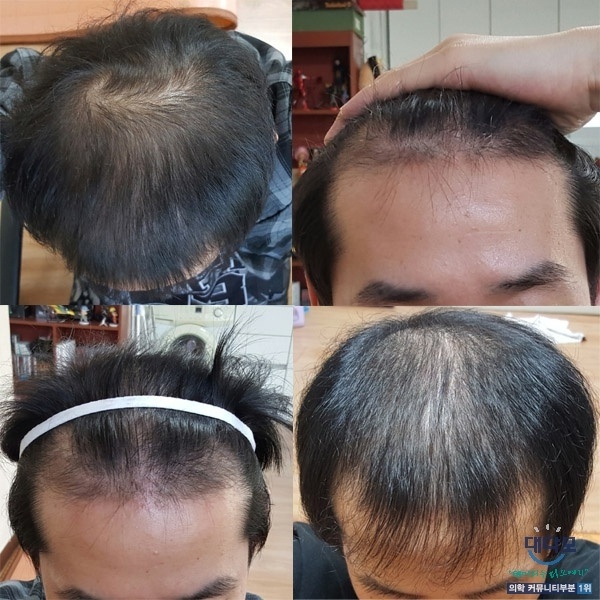 daedamo_com_20170206_214848.jpg