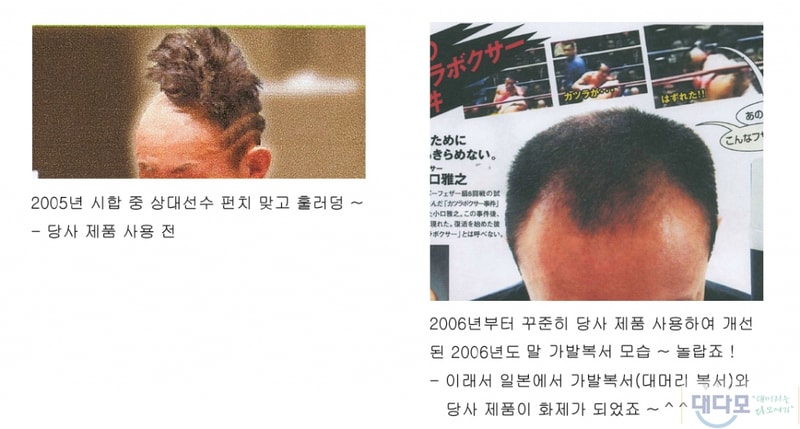 일본대머리가발복서.jpg