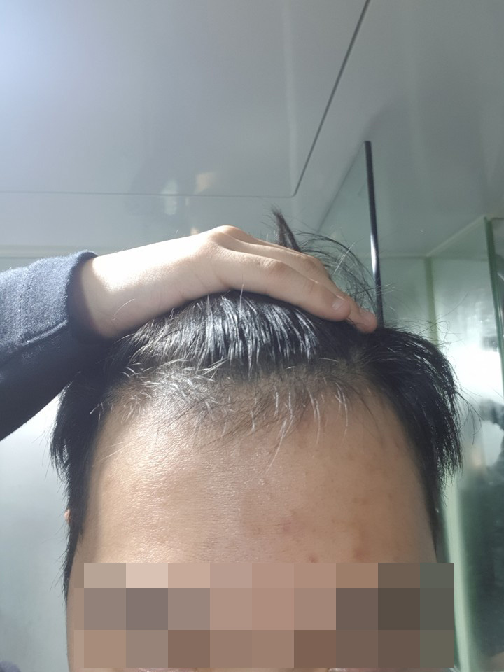 앞머리1.jpg