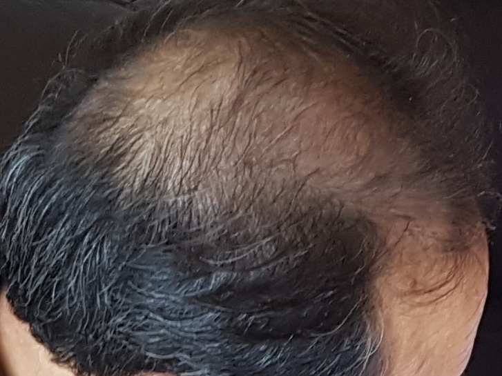 20181117_173428.jpg