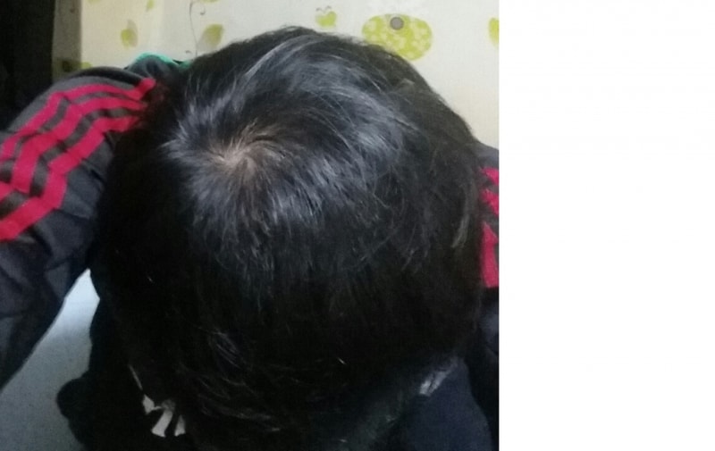 11개월차.jpg