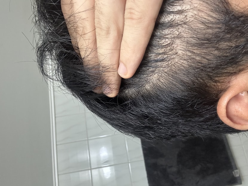 말린후 연모화된 옆머리 사진