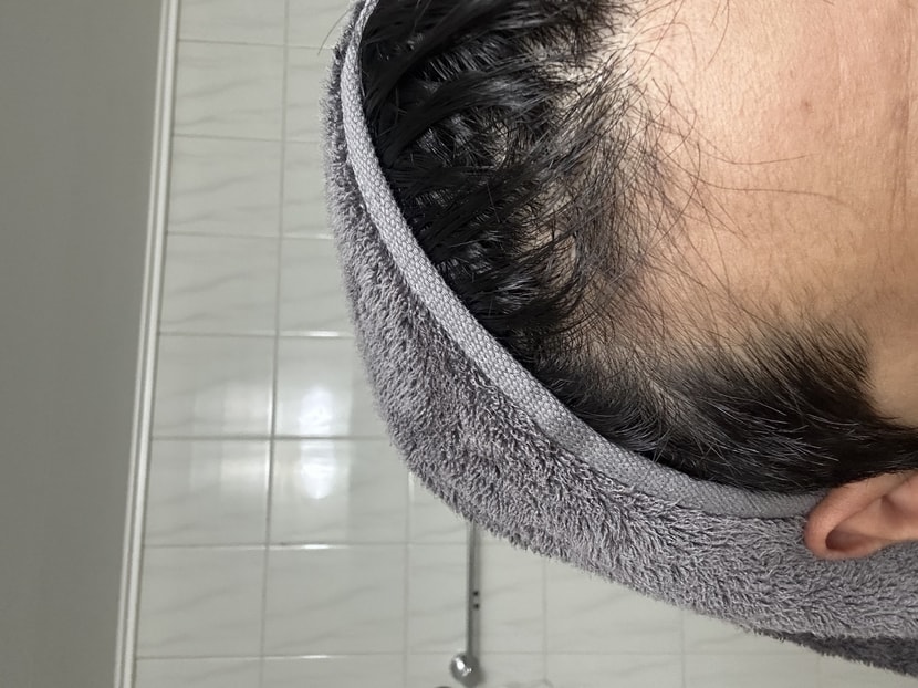 오른쪽 말리기전 
