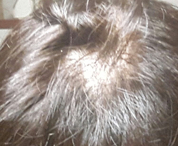 20170608_215918-1.jpg