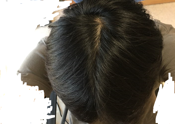 정수리.png