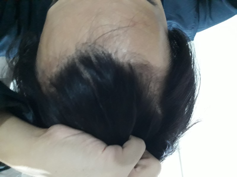 20180302_100956.jpg