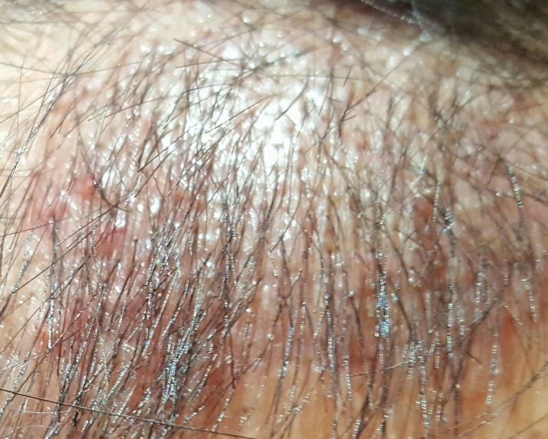20170204_204608.jpg