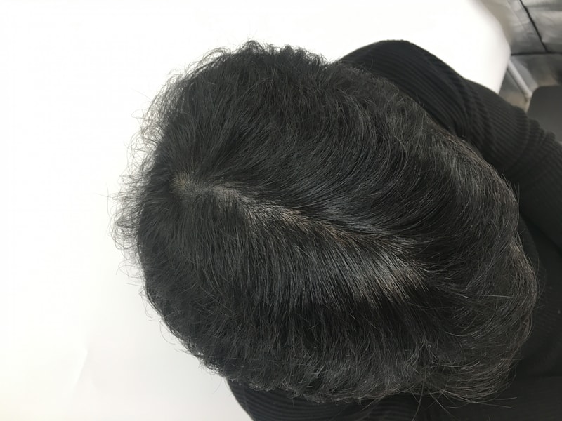 주사맞기전 머리통.jpg