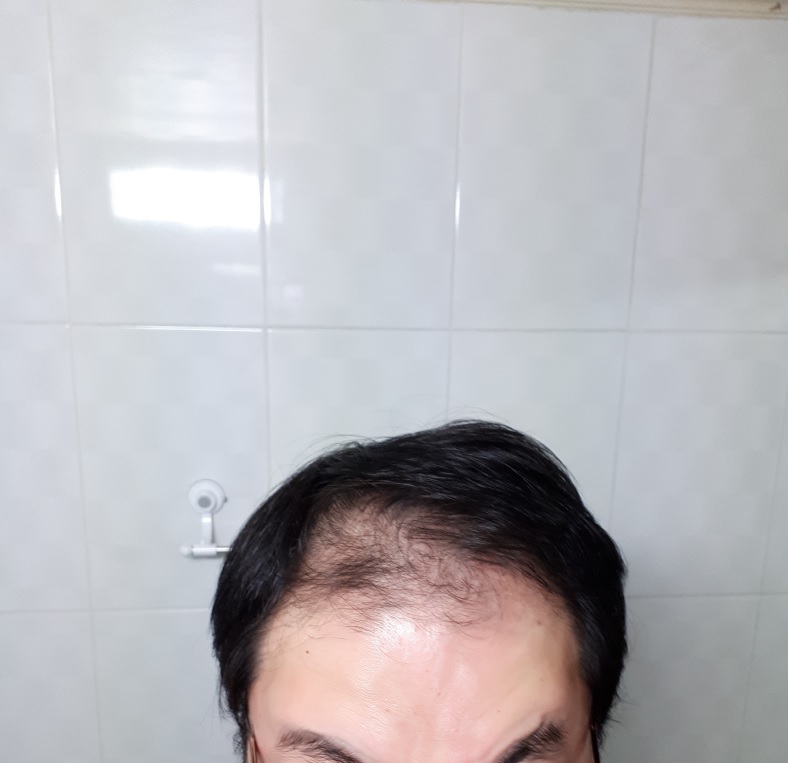머리1.jpg