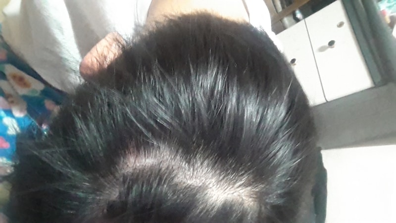 20170302_004527.jpg