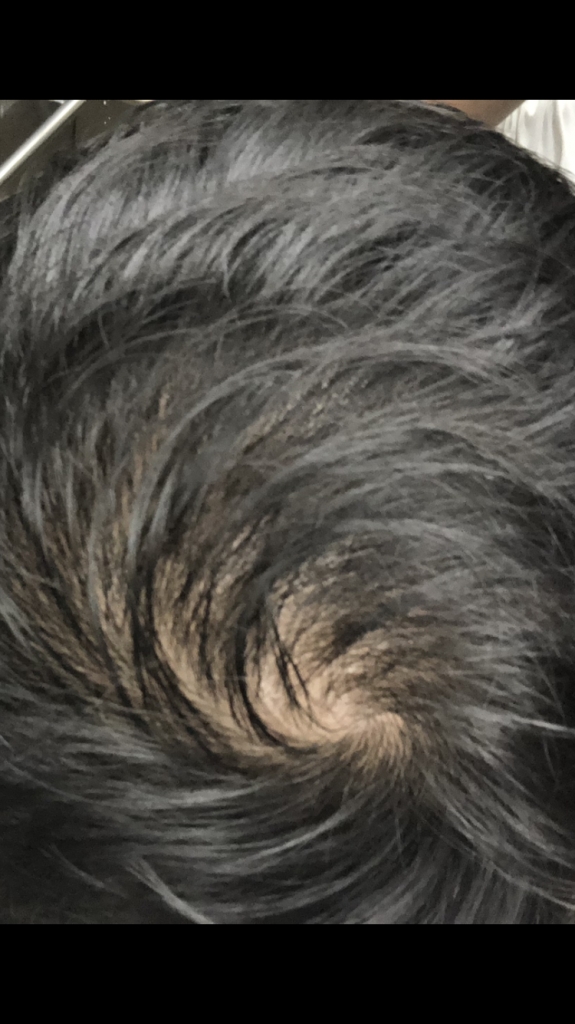 714478B7-5EC5-4F61-A765-C9897255ADE6.png