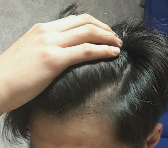 IMG_20160116_1.png