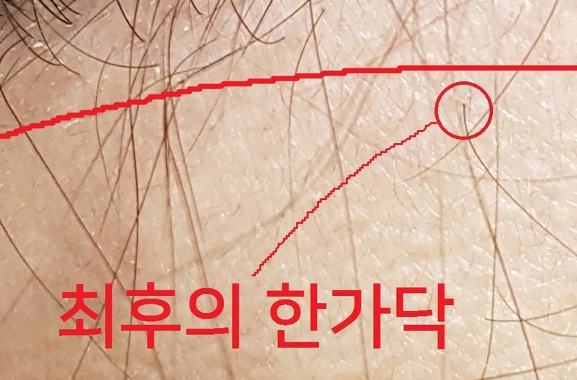 확대