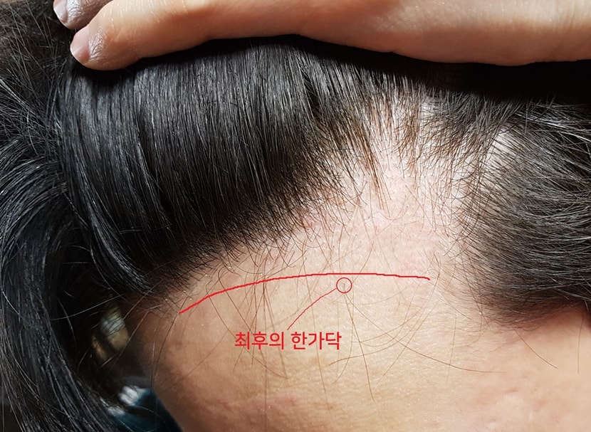 최후의 한 가닥