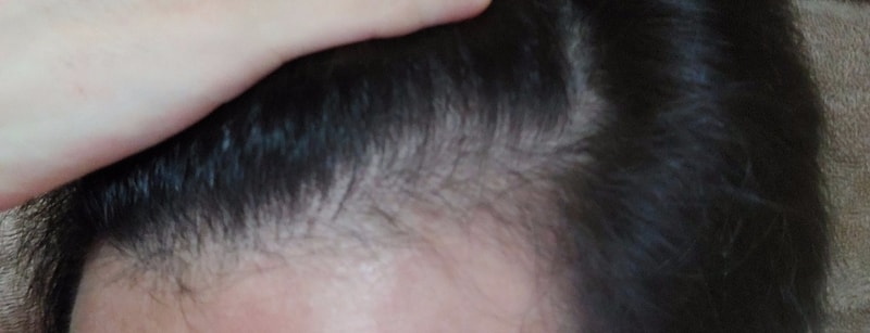 B612_20201106_065957_510~2.jpg