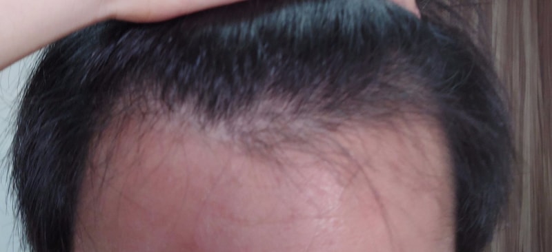 B612_20201105_113018_915~2.jpg
