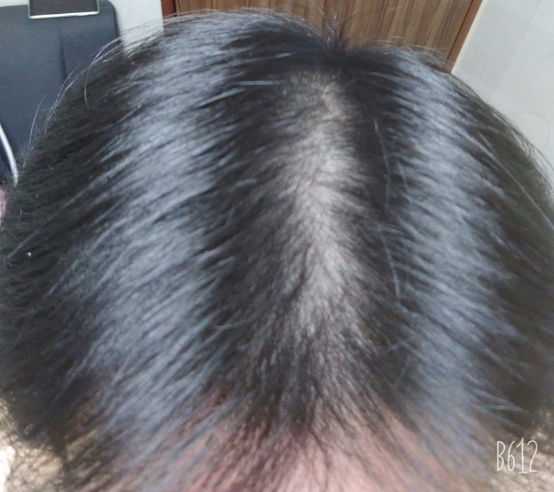 B612_20201105_213531_560~2.jpg