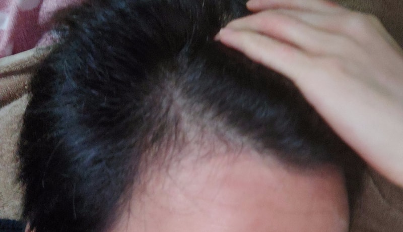 B612_20201106_070844_971~2.jpg