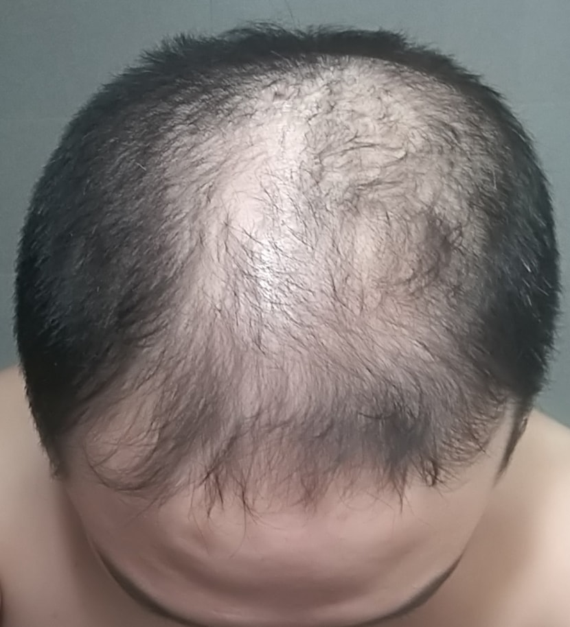 먹기 시작한날