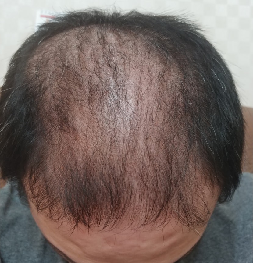 30일 경과