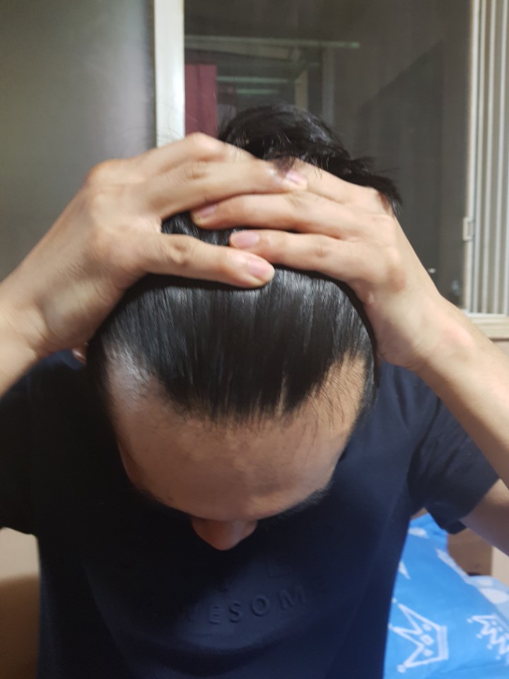 KakaoTalk_20170725_010634856.jpg