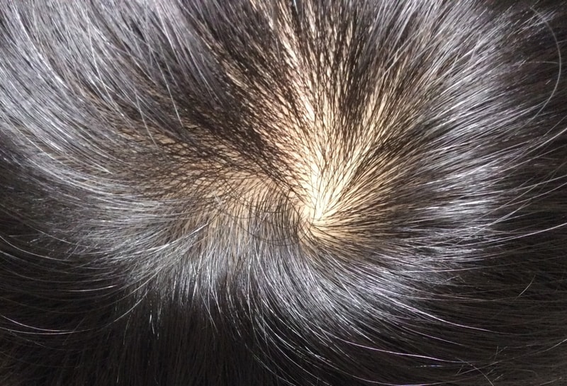 20140109정수리.JPG