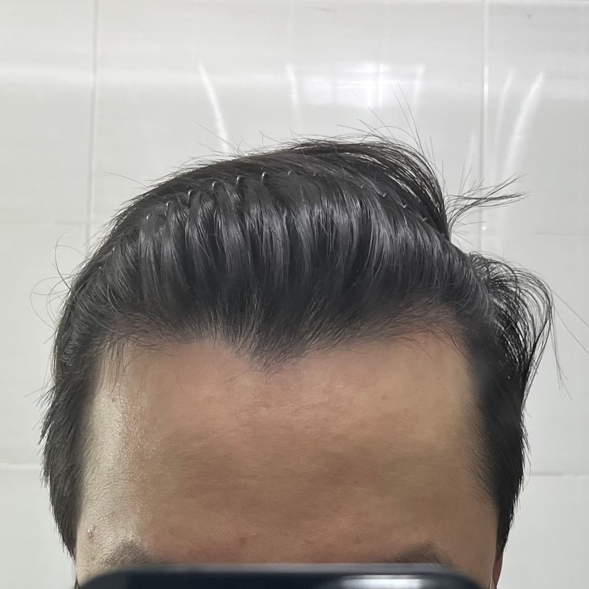 정면