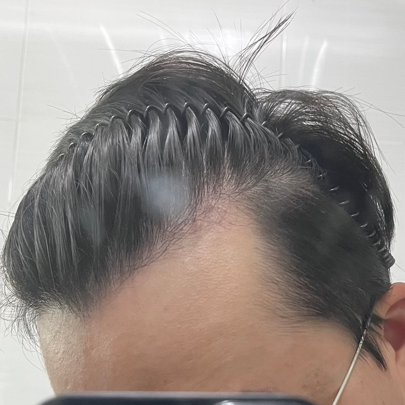 숙인 우측