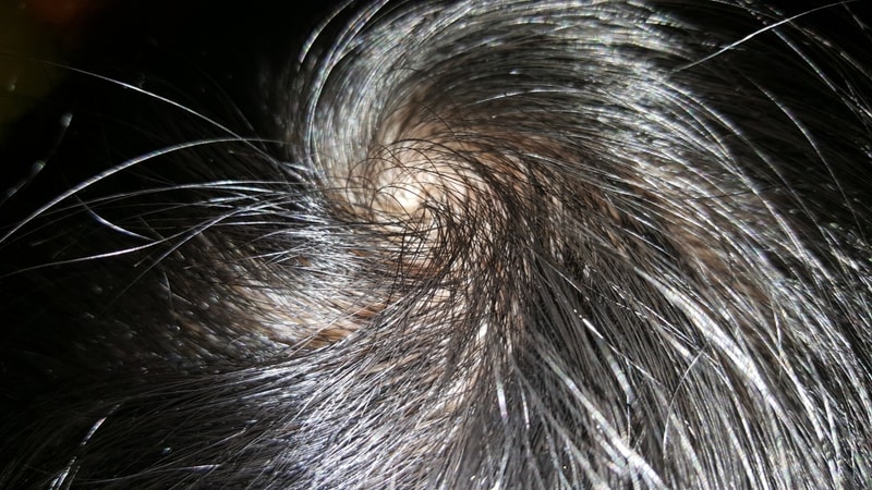 20180305_195345.jpg