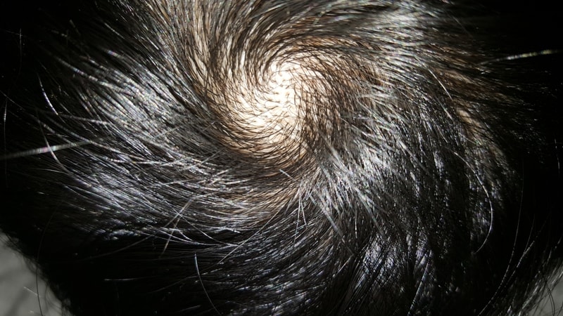 20180305_195408.jpg